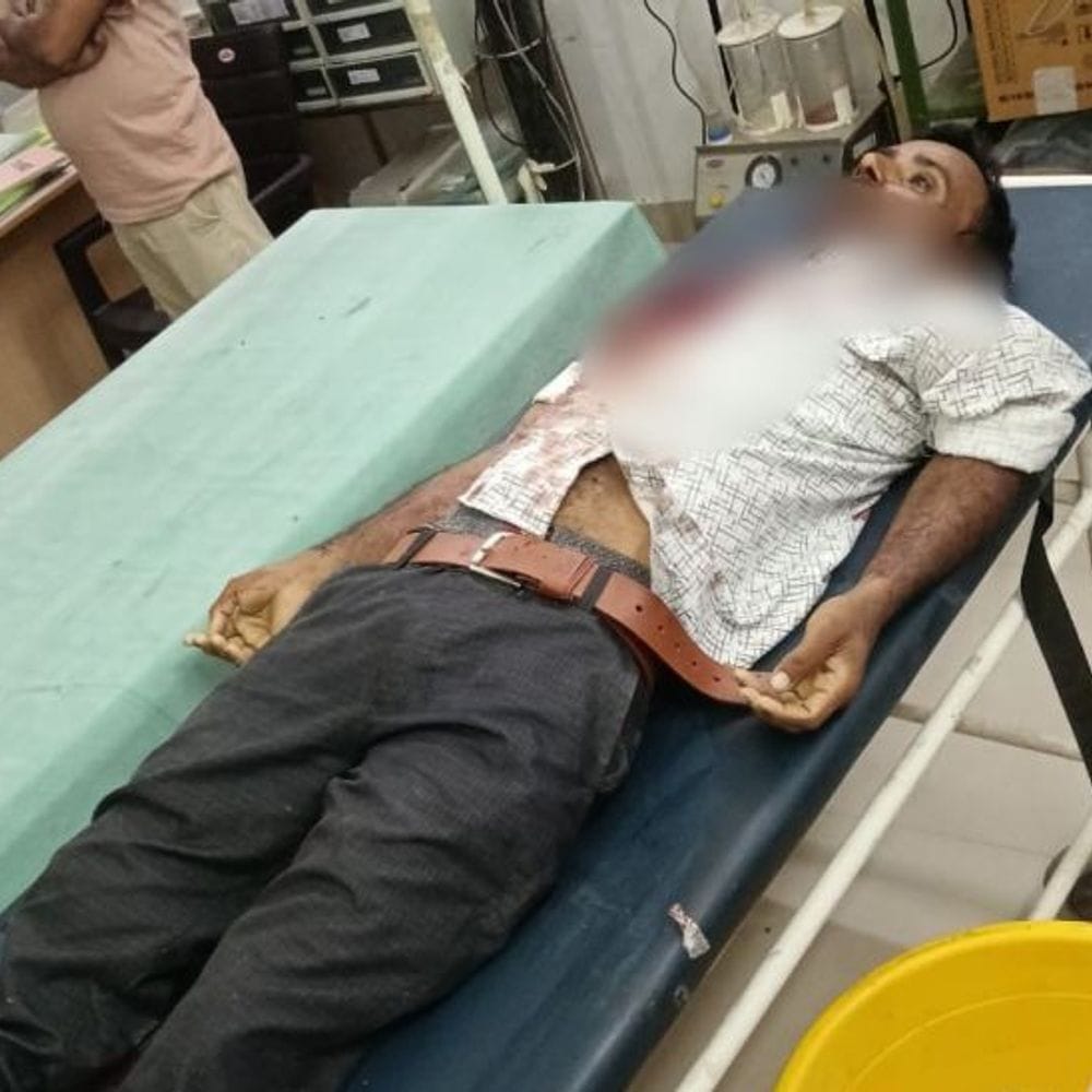 ऑटो रिक्शा खंभे से टकराया, एक युवक की मौत:शिवगंज-देवली मार्ग पर हादसा, पुलिस जांच में जुटी