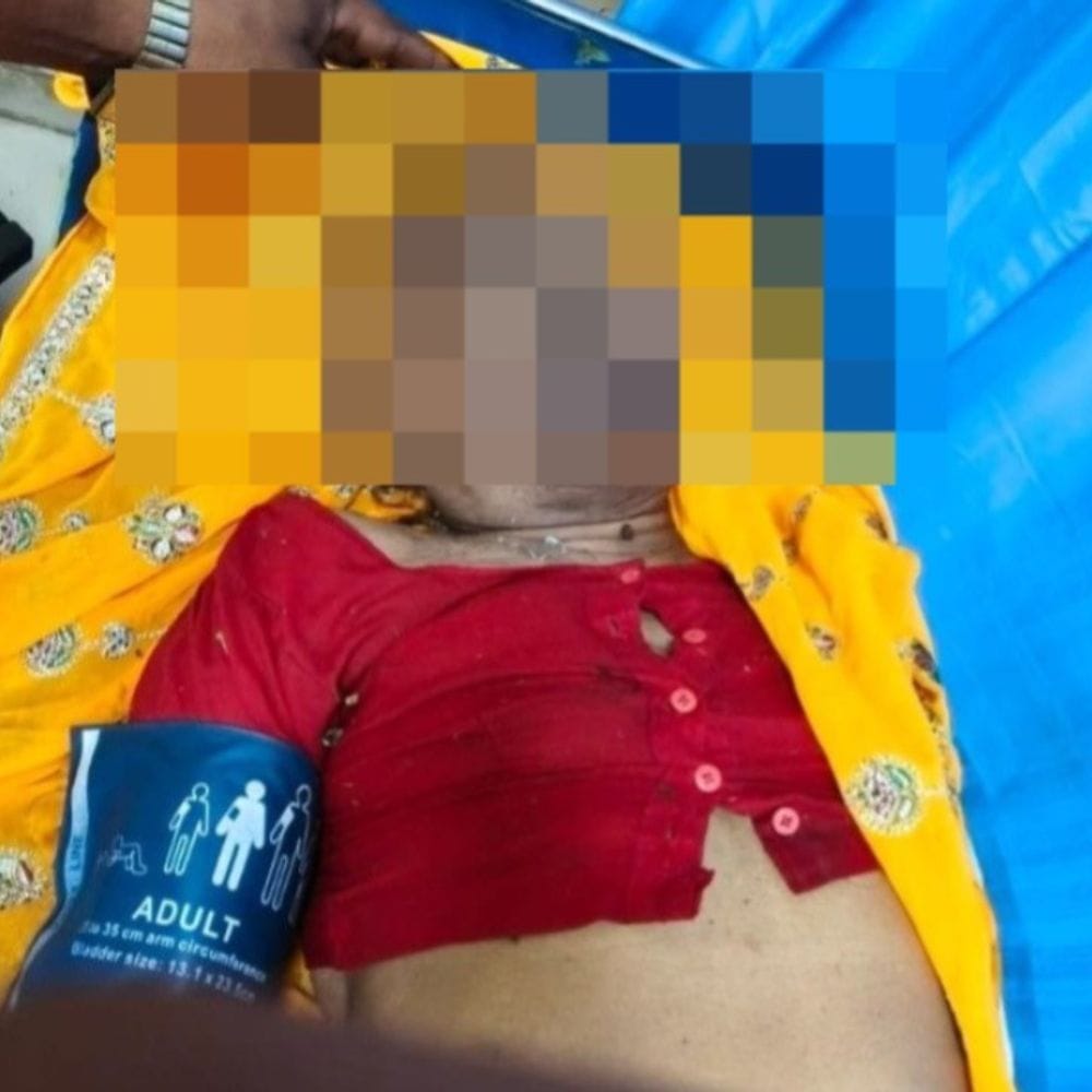 जयपुर में 20 फीट गहरे लिफ्ट शाफ्ट में गिरी महिला,मौत:बाथरूम का दरवाजा समझ लिफ्ट का चेनल गेट खोलने से हादसा, हॉस्पिटल में तोड़ा दम