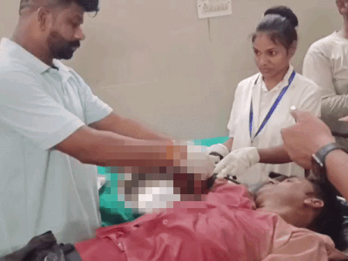ट्रेलर की टक्कर से पिकअप ड्राइवर का हाथ कटा:साथी ने लोगों की मदद से हॉस्पिटल पहुंचाया, आरोपी फरार
