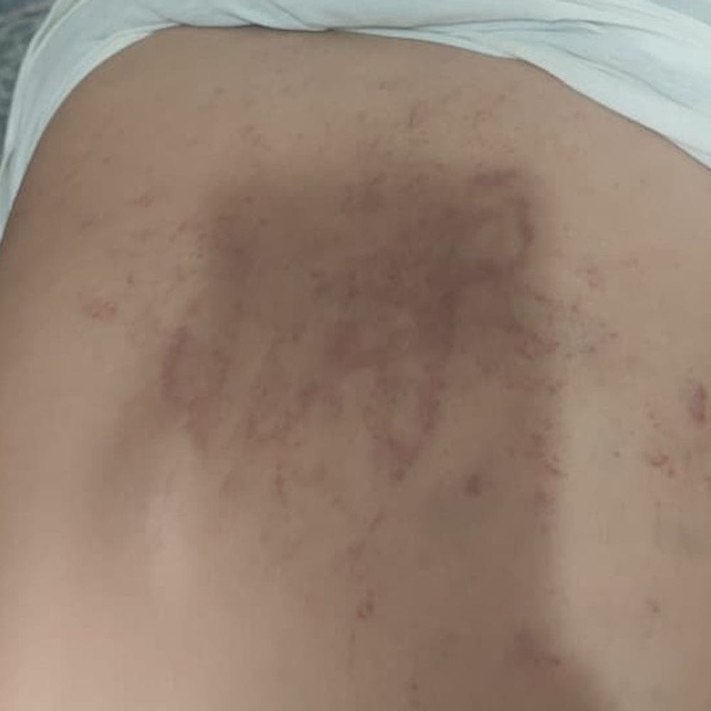 हॉस्टल में स्टूडेंट्स से मारपीट मामले में क्रॉस केस दर्ज:16 साल के नाबालिग को बंधक बनाकर पीटा था, वीडियो बनाकर रंगदारी मांगने का आरोप