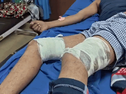 कोटा में युवक के पैरों-पीठ पर चाकू घोंपे:काम से लौटते समय बदमाशों ने किया हमला, आरोपियों पर पत्थर फेंककर खुद को बचाया