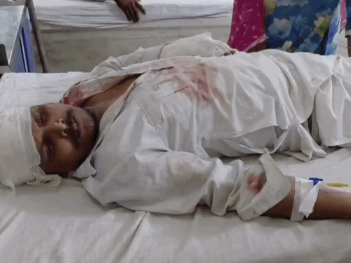 घर के बाहर गाड़ी खड़ी करने पर 2 पक्ष भिड़े:लाठी-सरियों और पत्थरों से किया हमला, 4 घायल