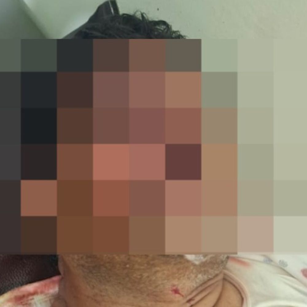 जयपुर में ज्वेलर्स से 35 लाख की लूट:कार से आए नकाबपोश बदमाशों ने किया हमला; सिर-नाक में गंभीर चोट, हाथों में फ्रैक्चर