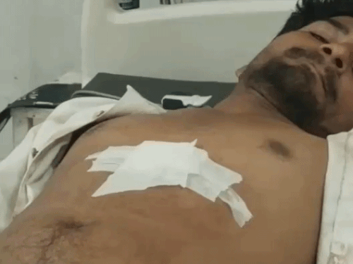 ढाबे पर बैठे युवक के सीने में चाकू मारा:गाली-गलौज के बाद किया हमला, घायल का इलाज जारी