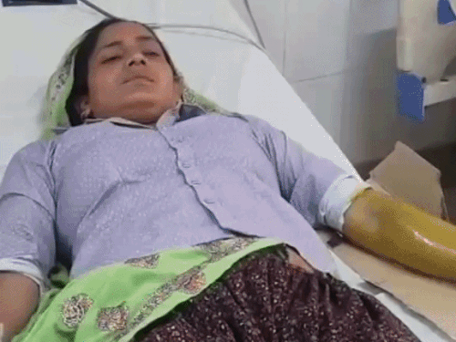 दो महिलाओं समेत तीन लोगों को सांप ने काटा:रात को सोते युवक के होठ पर काटा, झाड़ू लगा रही महिला के पैर पर डसा