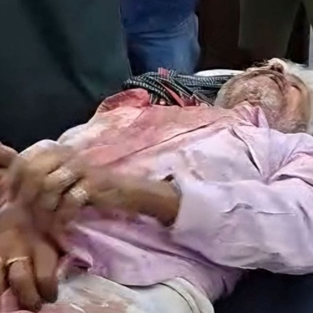 नशे में छोटे भाई ने धारदार हथियार से किया हमला:भाई-भाभी और भतीजा घायल, बांगड़ हॉस्पिटल में इलाज जारी