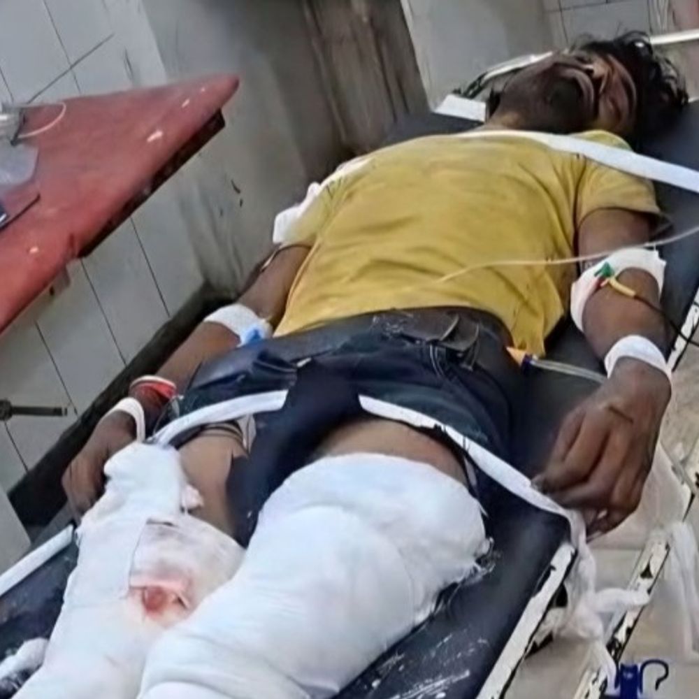 पाली में दो ट्रकों की भिड़ंत, ड्राइवर की मौत:हाईवे पर हाथलाई गांव के पास देर रात हुआ हादसा, जोधपुर में इलाज के दौरान तोड़ा दम