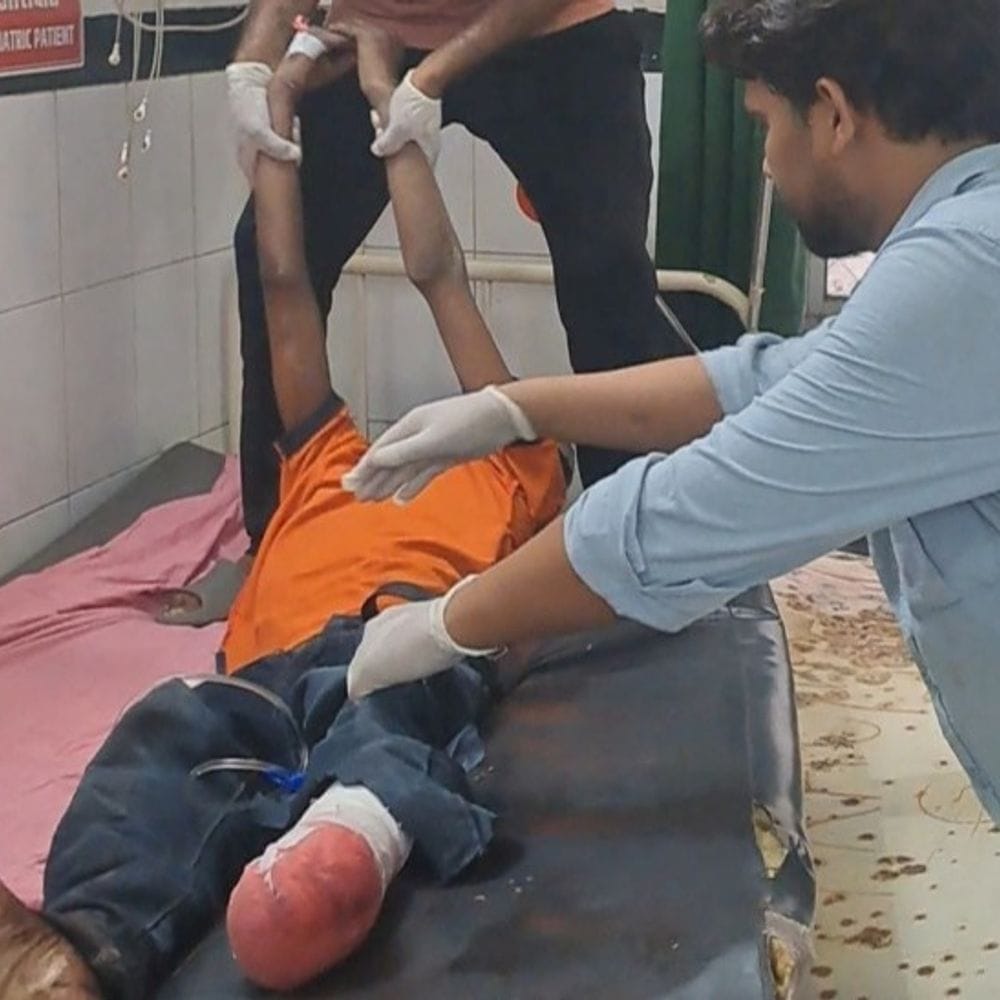 पाली में मधुमक्खियों के डंक से बुजुर्ग घायल:ट्रेन से गिरने से यात्री का पैर कटा; दोनों का बांगड़ हॉस्पिटल में इलाज जारी