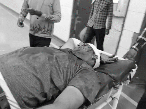 पुलिसकर्मी के परिवार पर तलवारों से हमला:4 के सिर फोड़े, महिलाओं समेत 6 घायल, खेत की डोल पर विवाद