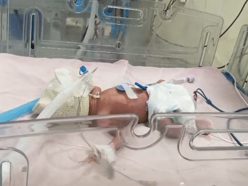 महिला ने एक साथ 4 बच्चों को दिया जन्म:पति बोला- मैंने तो 1 बेटी की उम्मीद की थी, भगवान ने 3 दे दी और 1 बेटा भी दिया