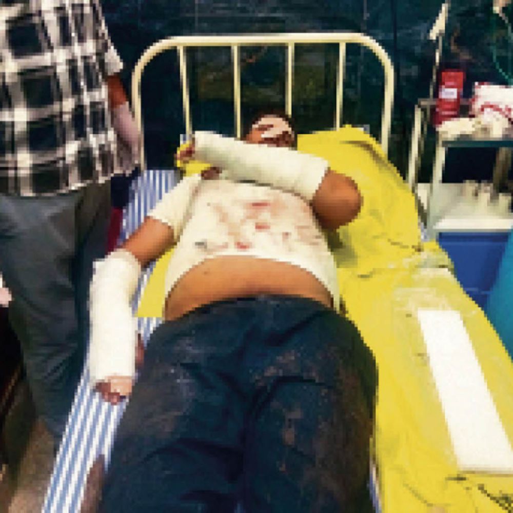 मारपीट व लूट का मामला:कार में आए 4 बदमाश, बाइक पर घर जा रहे ज्वैलर को रोककर पीटा, 1 तोला सोना, 8 किलो चांदी लूटी