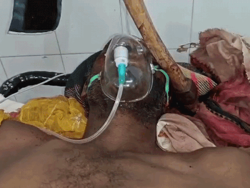 युवक पर कुल्हाड़ी से हमला, सिर में धंसी:कोटा में 3 घंटे चला ऑपरेशन; डॉक्टर बोले- हालत नाजुक, अगले 8 दिन महत्वपूर्ण