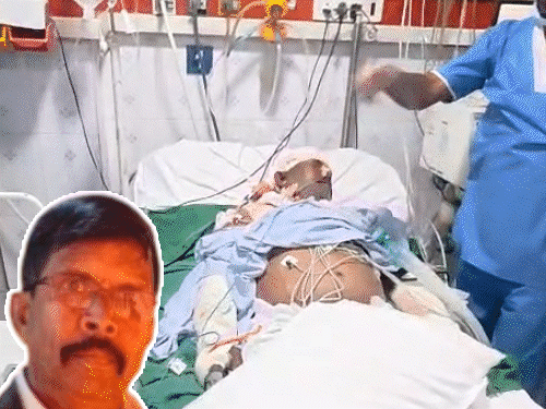 वेंटिलेटर का ऑक्सीजन पाइप नहीं लगाया, मरीज की मौत:परिजनों ने किया हंगामा, अस्पताल ने गलती मानी; सिर के ऑपरेशन के बाद ICU में थे भर्ती