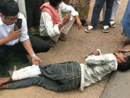 सड़क पर तड़पते युवक की CMHO ने ड्रेसिंग की:हादसा देख गाड़ी रुकवाई, एम्बुलेंस बुला कर अस्पताल पहुंचाया
