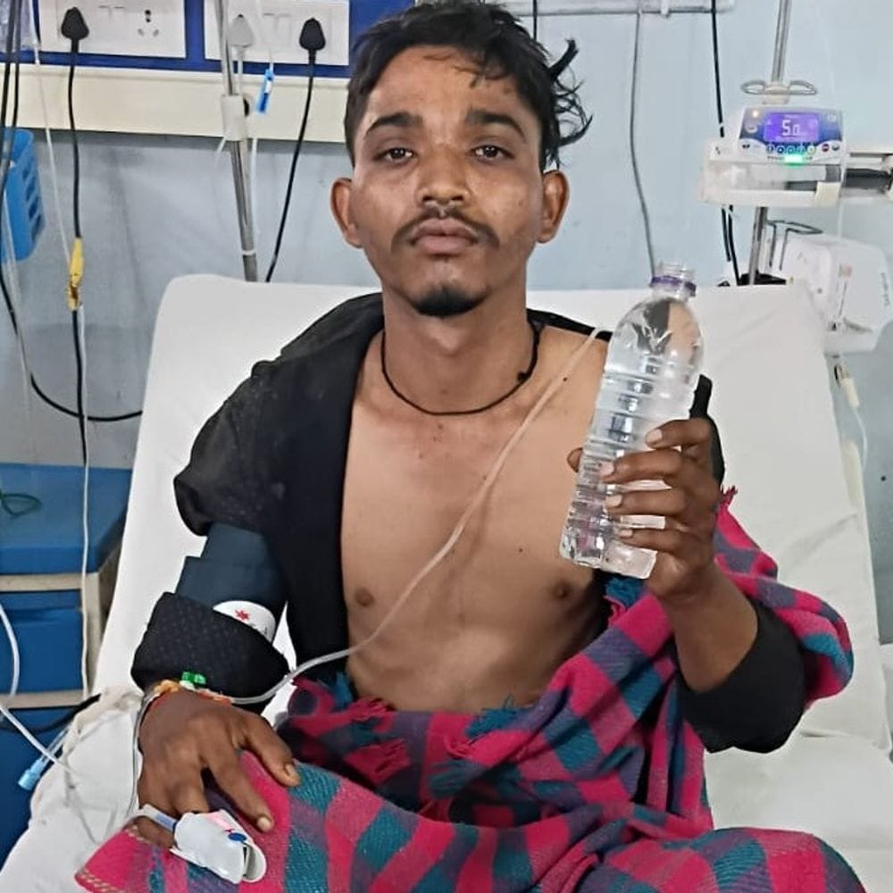 सांप के जहर से थमने लगी थीं सांसें:वेंटिलेटर पर रखकर युवक की जान बचाई, 24 घंटे बाद आया होश