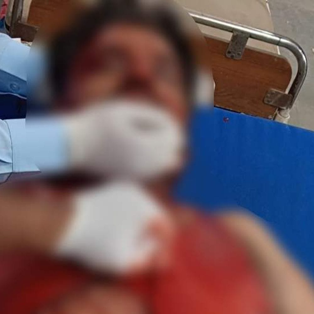 सिगरेट उधार नहीं देने पर दुकानदार पर चाकू से हमला:ताबड़तोड़ वार करने से लहूलुहान होकर जमीन पर गिरा, आईसीयू में भर्ती