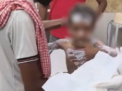 स्कूल वैन का रेडिएटर फटा, तीन मासूम झुलसे:पाइप फटने से गर्म पानी का फव्वारा निकला था, 11 बच्चे सवार थे