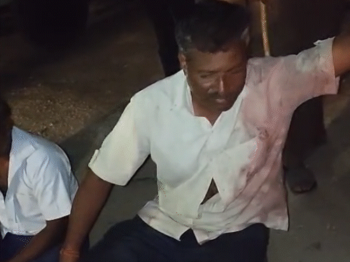 हिरण का शिकार करते पकड़े गए, मांस बरामद:गांव वालों को देखते ही भागने लगे, बोलेरो से 10 किमी पीछा कर दबोचा
